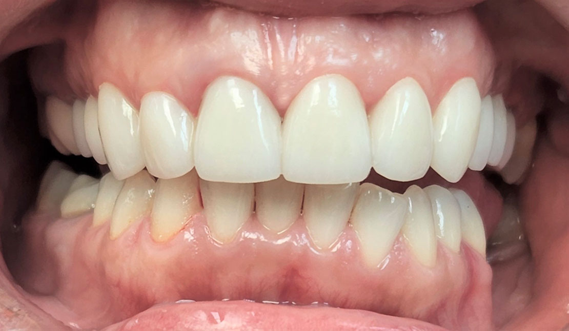 Patient 2, after dental treatment by Dr. Stepanenkov