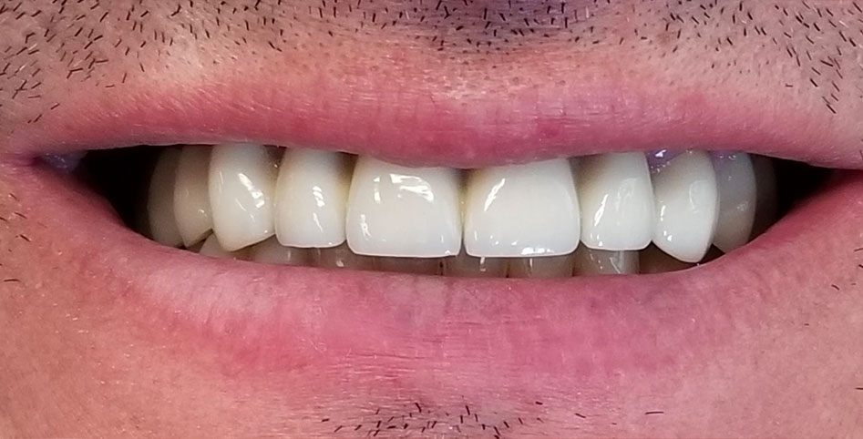 Patient 3, after dental treatment by Dr. Stepanenkov