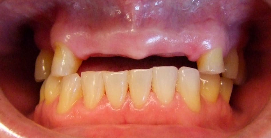 Patient 3, before dental treatment