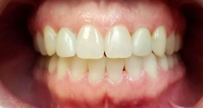 Patient 4, after dental treatment by Dr. Stepanenkov